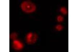 ABIN6274476 staining Hela cells by IF/ICC. (ZNF668 antibody  (Internal Region))
