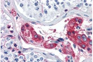 Human Testis (formalin-fixed, paraffin-embedded) stained with F12 antibody ABIN364435 at 5 ug/ml followed by biotinylated anti-goat IgG secondary antibody ABIN481715, alkaline phosphatase-streptavidin and chromogen. (F12 antibody)