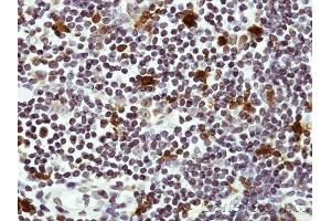 Immunohistochemical staining of paraffin-embedded Human lymph tissue using HICE1 antibody at a dilution of 1:50
