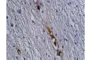 Immunohistochemistry (IHC) image for anti-Synaptophysin (SYP) antibody (ABIN1109181) (Synaptophysin antibody)