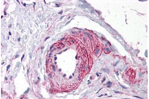 Human Vessel: Formalin-Fixed, Paraffin-Embedded (FFPE) (ERG antibody  (AA 1-160))