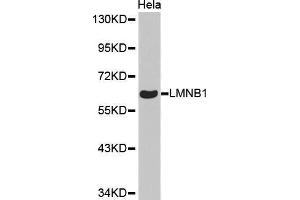 Western Blotting (WB) image for anti-Lamin B1 (LMNB1) antibody (ABIN1513160) (Lamin B1 antibody)
