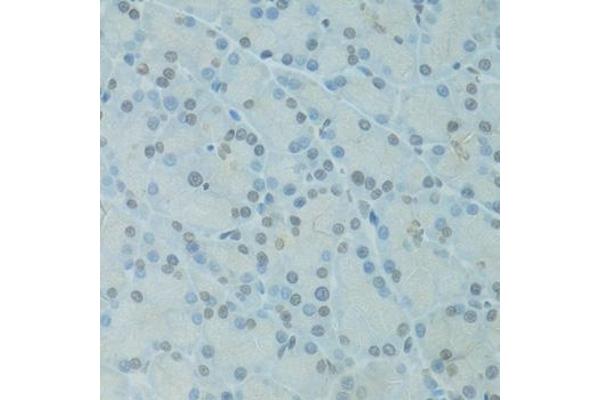 GTF2H2C antibody  (AA 1-300)