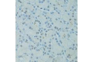 Immunohistochemistry of paraffin-embedded rat pancreas using GTF2H2C antibody  at dilution of 1:100 (40x lens). (GTF2H2C antibody  (AA 1-300))