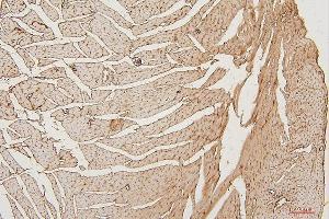 IHC analysis of PPCS using anti-PPCS antibody (ABIN7602752).