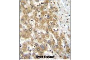 NPS3A Antibody (Center) (ABIN655107 and ABIN2844739) immunohistochemistry analysis in formalin fixed and paraffin embedded human liver tissue followed by peroxidase conjugation of the secondary antibody and DAB staining. (NIPSNAP3A antibody  (AA 74-102))