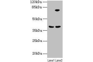 Western blot All lanes: ANXA9 antibody at 8 μg/mL Lane 1: Mouse kidney tissue Lane 2: A431 whole cell lysate Secondary Goat polyclonal to rabbit IgG at 1/10000 dilution Predicted band size: 39 kDa Observed band size: 39 kDa (Annexin A9 antibody  (AA 8-345))