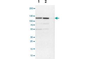 Western blot anyalysis of Lane 1: NIH-3T3 cell lysate (Mouse embryonic fibroblast cells), Lane 2: NBT-II cell lysate (Rat Wistar bladder tumour cells), Lane 3: PC12 cell lysate (Pheochromocytoma of rat adrenal medulla) with NCAPH polyclonal antibody .