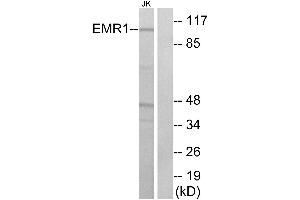 Western blot analysis of extracts from Jurkat cells, using EMR1 antibody. (F4/80 antibody  (C-Term))