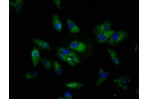 Immunofluorescence staining of Hela cells with ABIN7169553 at 1:133, counter-stained with DAPI. (Sialoadhesin/CD169 antibody  (AA 572-697))