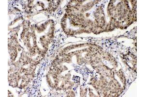 IHC analysis of XRCC1 using anti-XRCC1 antibody . (XRCC1 antibody  (AA 538-633))