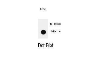 Dot blot analysis of anti-PIK3CD-p Pab (ABIN389877 and ABIN2839731) on nitrocellulose membrane. (PIK3CD antibody  (pTyr485))