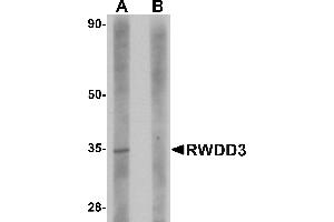 Western blot analysis of RWDD3 in rat kidney tissue lysate with RWDD3 antibody at 1 µg/mL in (A) the absence and (B) the presence of blocking peptide. (RWDD3 antibody  (C-Term))