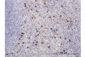 Immunoperoxidase of monoclonal antibody to KCNIP2 on formalin-fixed paraffin-embedded human tonsil. (KCNIP2 antibody  (AA 1-100))