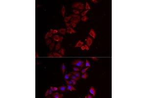 Immunofluorescence analysis of MCF7 cells using LIMS1 Polyclonal Antibody (LIMS1 antibody)
