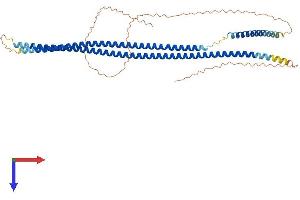 KRT16 Protein (AA 1-473) (His tag)