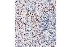 Immunohistochemical analysis of (ABIN1537232 and ABIN2838268) on paraffin-embedded human spleen tissue was performed on the Leica®BOND RXm. (DEFa3 antibody  (C-Term))