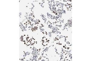 Immunohistochemical analysis of  on paraffin-embedded Human lung tissue.
