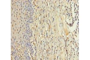 Immunohistochemistry of paraffin-embedded human tonsil tissue using ABIN7176084 at dilution of 1:100