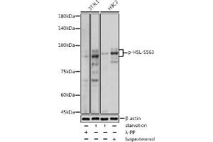 Western blot analysis of extracts of various cell lines, using Phospho-HSL-S563 antibody (ABIN7268278) at 1:1000 dilution. (LIPE antibody  (pSer563))