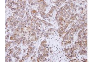 IHC-P Image Immunohistochemical analysis of paraffin-embedded FaDu xenograft, using CD2-associated protein, antibody at 1:500 dilution. (CD2AP antibody)