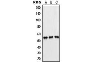 Western blot analysis of PFKFB1/4 expression in Jurkat (A), H1299 (B), HeLa (C) whole cell lysates. (PFKFB1/4 antibody  (Center))