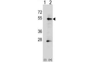 Western blot analysis of ALPP (arrow) using rabbit polyclonal ALPP Antibody (N-term) . (PLAP antibody  (N-Term))
