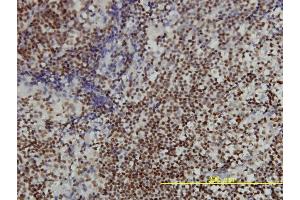 Immunostaining (ISt) image for anti-Acidic (Leucine-Rich) Nuclear phosphoprotein 32 Family, Member A (ANP32A) (AA 1-249) antibody (ABIN563549)