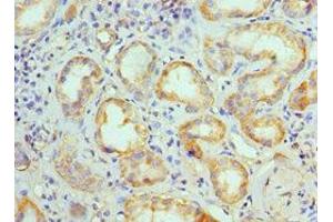 Immunohistochemistry of paraffin-embedded human kidney tissue using ABIN7145103 at dilution of 1:100 (ATG13 antibody  (AA 318-517))