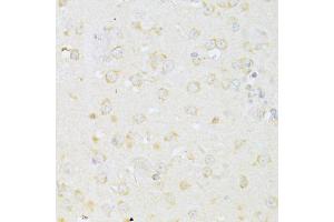 Immunohistochemistry of paraffin-embedded mouse brain using CHRNA7 antibody (ABIN4903285) at dilution of 1:100 (40x lens). (CHRNA7 antibody)