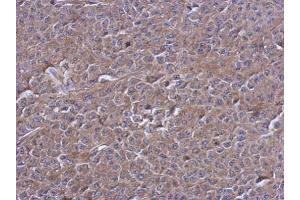 IHC-P Image Immunohistochemical analysis of paraffin-embedded D54 xenograft, using PTPN12, antibody at 1:500 dilution. (PTPN12 antibody  (N-Term))