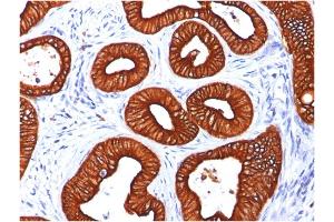 Immunohistochemistry (IHC) image for anti-Keratin 18 (KRT18) antibody (ABIN6939932)