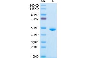 Human CLEC7A on Tris-Bis PAGE under reduced condition. (CLEC7A Protein (AA 66-201) (Fc Tag))