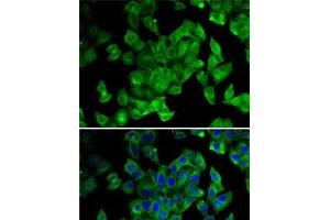 Immunofluorescence analysis of MCF7 cells using PPL Polyclonal Antibody (PPL antibody)