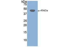 Detection of Recombinant DSG3, Human using Polyclonal Antibody to Desmoglein 3 (DSG3) (Desmoglein 3 antibody  (AA 858-999))