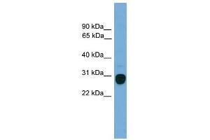 TREM2 antibody used at 1 ug/ml to detect target protein.