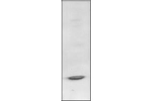 Western Blotting (WB) image for anti-B-Cell CLL/lymphoma 3 (BCL3) antibody (ABIN950631) (BCL3 antibody)
