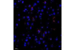 Immunofluorescence of paraffin embedded rat brain using Neurturin (ABIN7074832) at dilution of 1:1000 (400x lens) (Neurturin antibody)