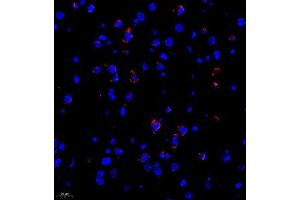 Immunofluorescence of paraffin embedded rat brain using Neurturin (ABIN7074832) at dilution of 1:1000 (400x lens) (Neurturin antibody)