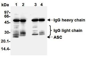 Western Blotting (WB) image for anti-PYD and CARD Domain Containing (PYCARD) antibody (ABIN1105662) (PYCARD antibody)