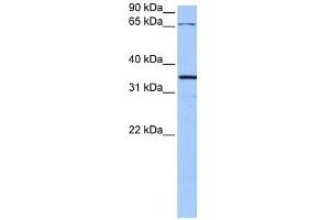 NLGN4X antibody used at 1 ug/ml to detect target protein. (Neuroligin 4 antibody  (N-Term))