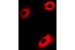 Immunofluorescent analysis of DLD staining in U2OS cells. (DLD antibody)