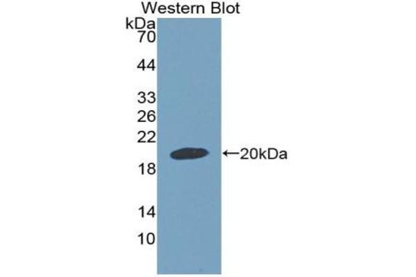 GDF9 antibody  (AA 306-440)
