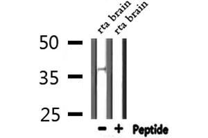 Western blot analysis of extracts from Rat brain, using AWAT1 Antibody. (AWAT1 antibody  (Internal Region))