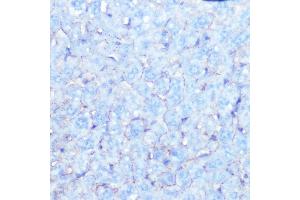 Immunohistochemistry of paraffin-embedded mouse liver using Na+/K+-ATPase Rabbit mAb (ABIN7270390) at dilution of 1:100 (40x lens). (ATP1A1 antibody)