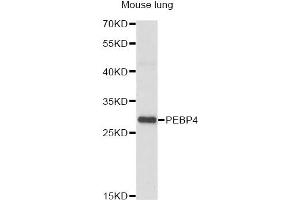 Western blot analysis of extracts of mouse lung, using PEBP4 antibody (ABIN6293825) at 1:1000 dilution.