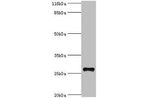 Western blot All lanes: TSPAN6 antibody at 20 μg/mL + Mouse liver tissue Secondary Goat polyclonal to rabbit IgG at 1/10000 dilution Predicted band size: 28 kDa Observed band size: 28 kDa (Tetraspanin 6 antibody  (AA 115-208))
