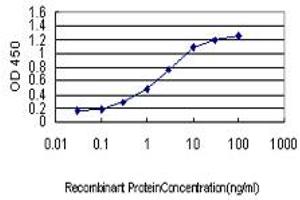 Detection limit for recombinant GST tagged RP6-213H19. (STK26/MST4 antibody  (AA 331-415))