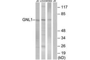 Western blot analysis of extracts from Jurkat/LOVO/K562 cells, using GNL1 Antibody. (GNL1 antibody  (AA 61-110))