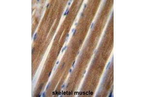 TNIP1 antibody (C-term) immunohistochemistry analysis in formalin fixed and paraffin embedded human skeletal muscle followed by peroxidase conjugation of the secondary antibody and DAB staining. (TNIP1 antibody  (C-Term))